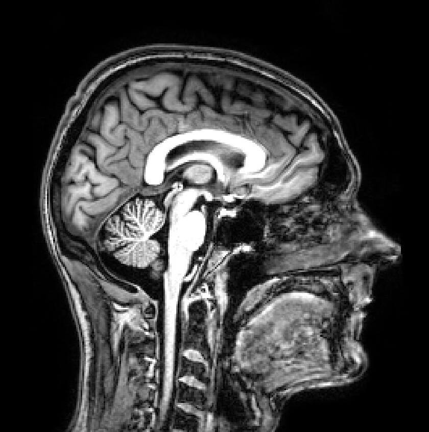 mybrain